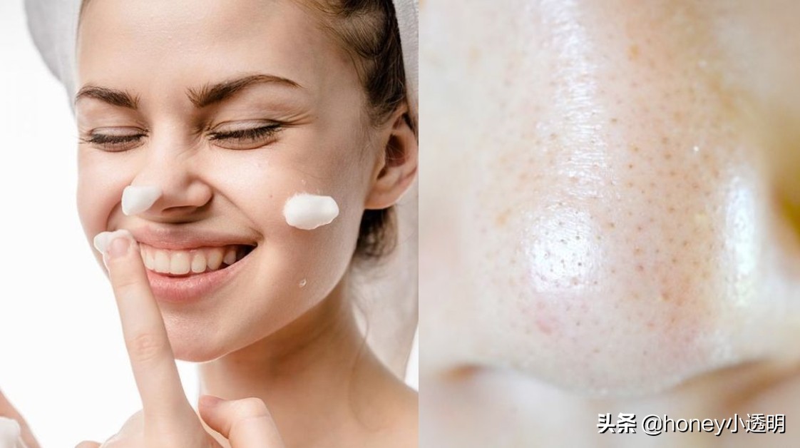 收缩毛孔改善毛孔粗大精华液,毛孔粗大有什么好修复