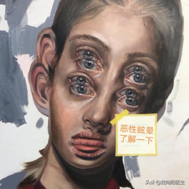 眩晕症和头晕的区别,头晕和眩晕如何区分