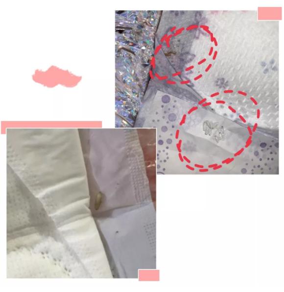卫生巾有小虫子是怎么回事,卫生巾有小虫子是什么牌子