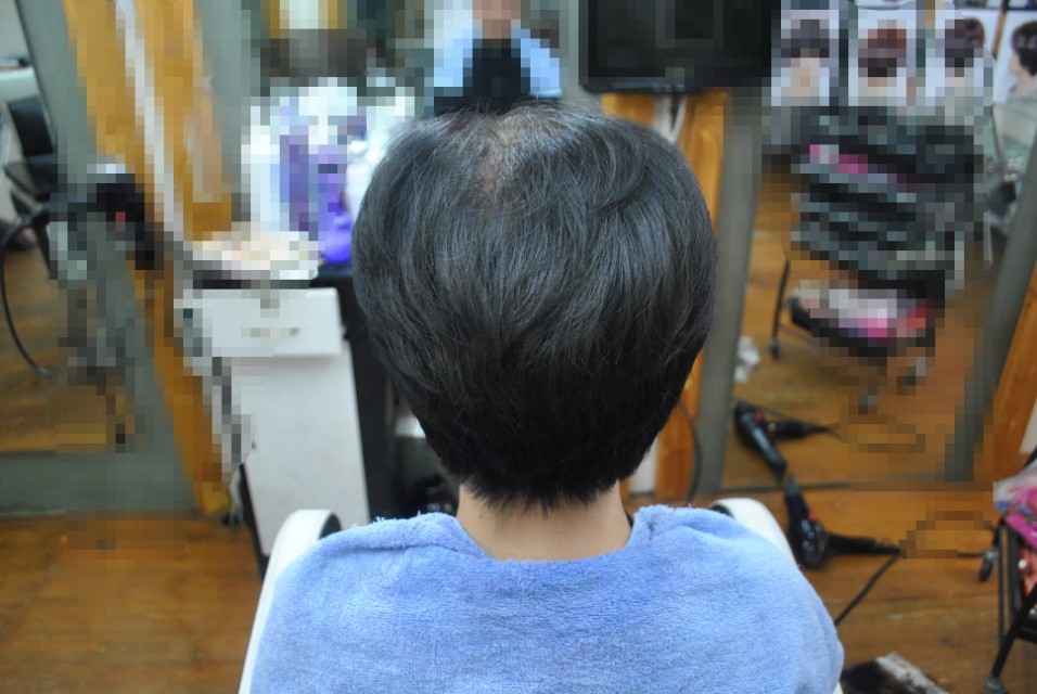 遮盖白发头顶的假发,假发遮盖白发发型