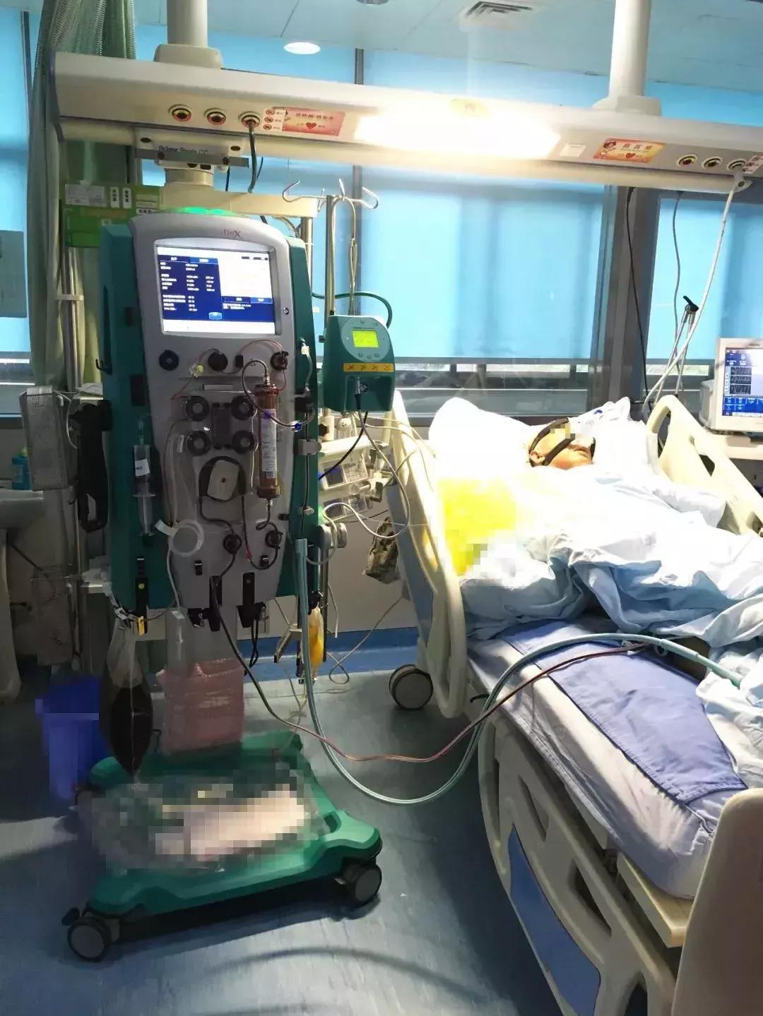 【关注】“超级过滤机”帮助74岁大爷转危为安