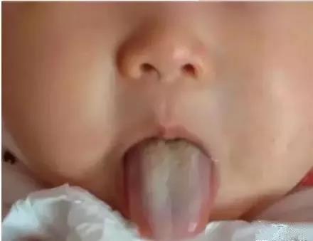 孩子发烧咳嗽腹胀便秘,宝宝积食发烧还咳嗽厉害