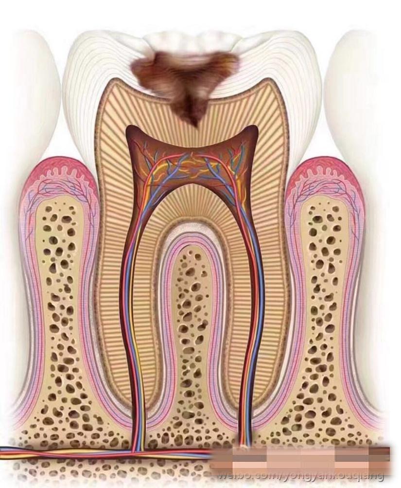 牙疼不是病疼起来要人命怎么安慰,牙疼不是病疼起来要命偏方