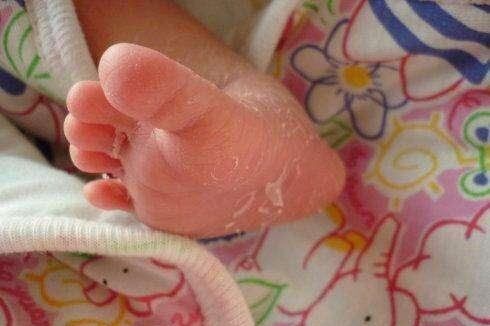 刚出生的宝宝怎样的表现是健康的,新生儿出生1-6个月常见问题