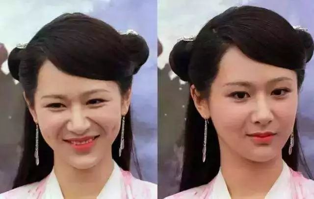 眼部细纹去皱的方法,眼角皱纹多用什么抗皱纹