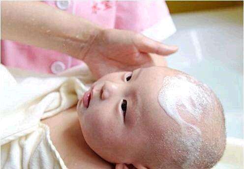 婴儿头皮上的黄痂抠了怎么办,抠头皮上面的痂
