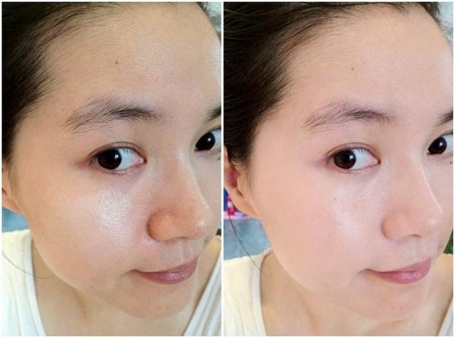 美白产品伤肾的危害,长期使用美白产品会导致肾衰竭吗