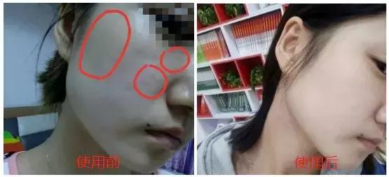 护肤反而皮肤差,改掉这些护肤恶习让你越变越美丽