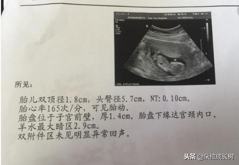 b超单显示后壁是前怀还是后怀,b超单上写了前壁是什么意思