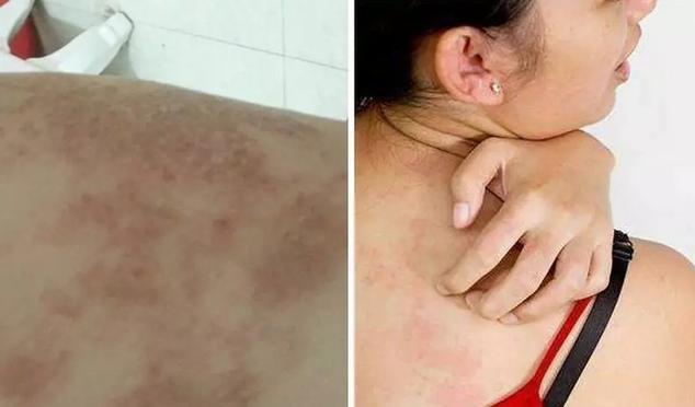 洗澡时搓出来的泥是怎么回事,为什么洗澡搓泥是白泥