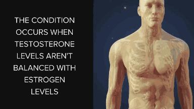 男生发育胸大怎么样锻炼,36岁男性胸部发育了怎么办