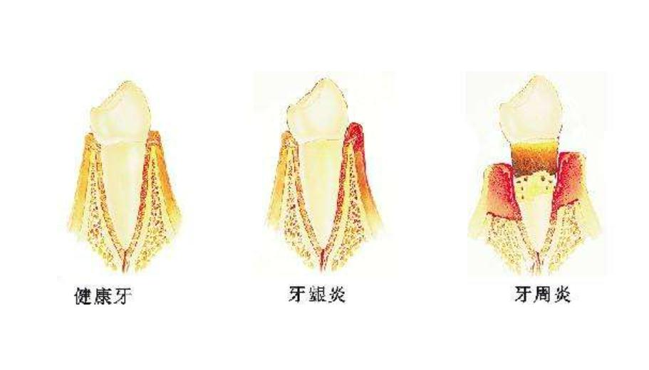 电动牙刷2023推荐平价,电动牙刷推荐2023年