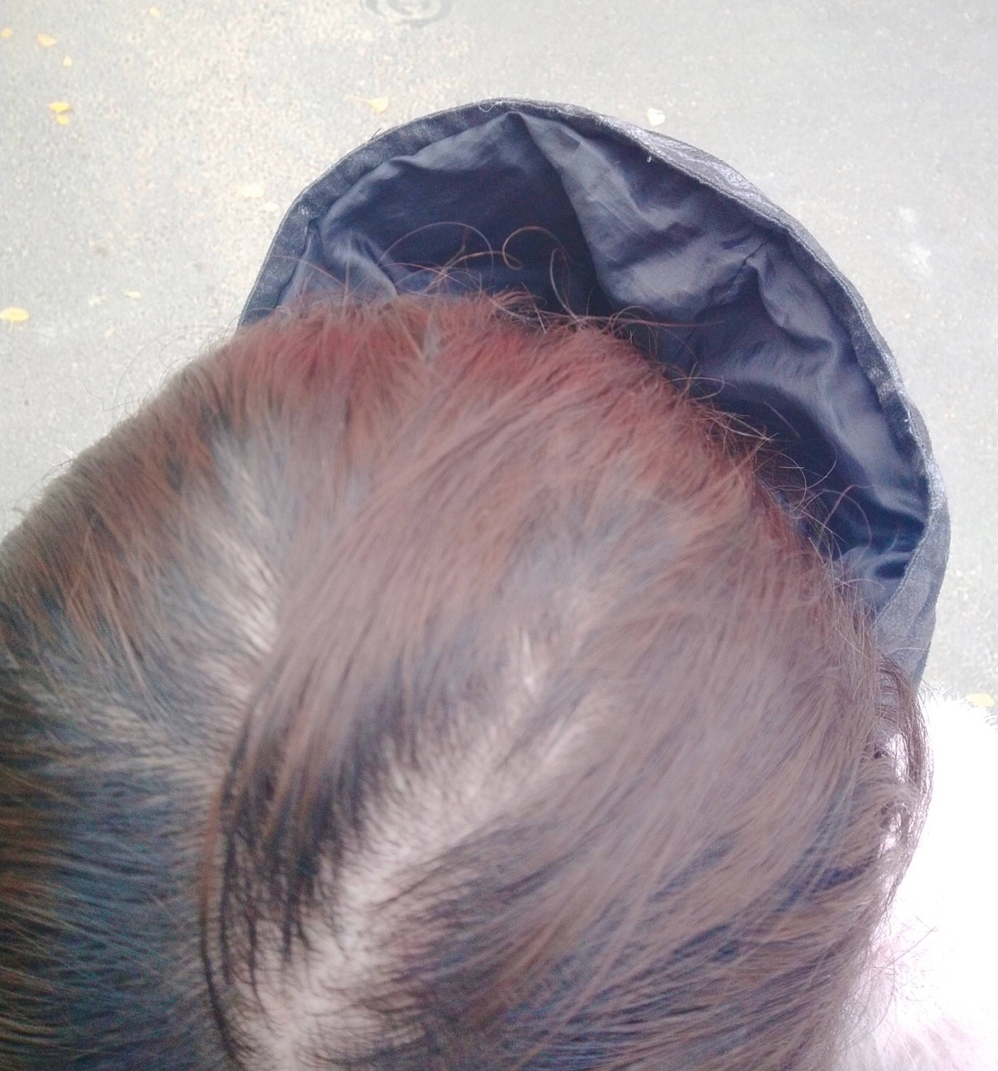 90后的你已经脱发了吗,90后脱发报告