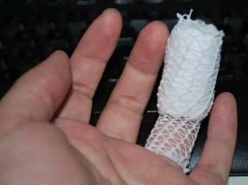 切菜切到手伤口太深后续怎么操作,切菜不小心把手切伤怎么办