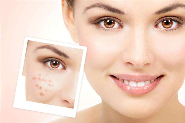 痘博士正确护肤方法,痘博士夏季护肤小妙招