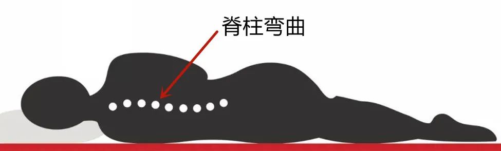 硬床好还是软包床好,腰椎间盘突出睡软床还是硬床垫好