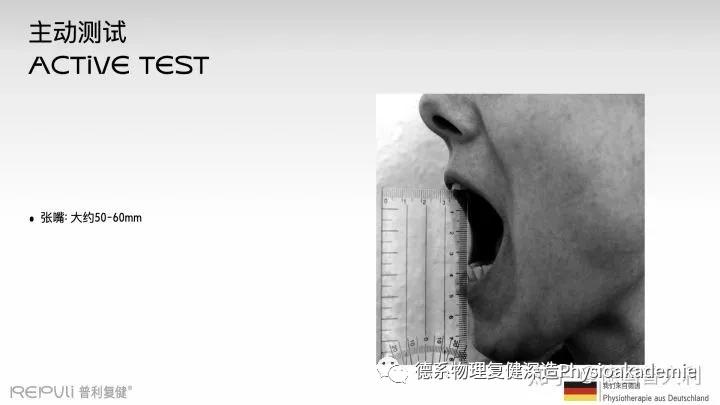 颞下颌关节紊乱综合征,颞下颌关节紊乱主要检查什么项目