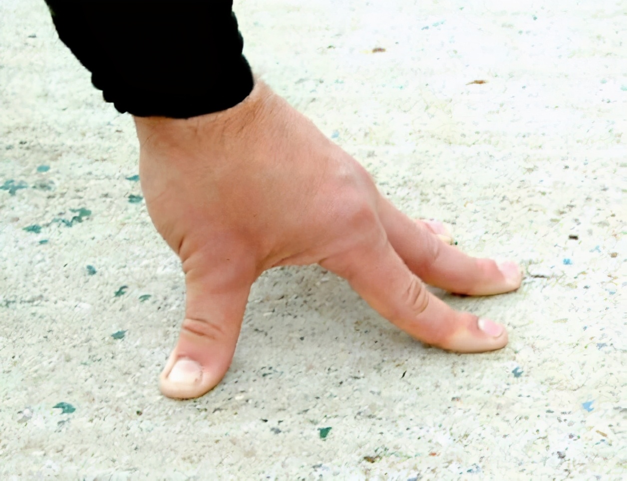 怎样对手腕进行抓握训练,如何让手腕更灵活练习抓握能力