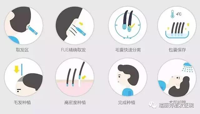 自体毛囊植发怎么植,自体毛发植发价格