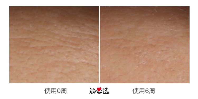 雅诗兰黛小棕瓶精华怎样买正品,雅诗兰黛小棕瓶100毫升最低价