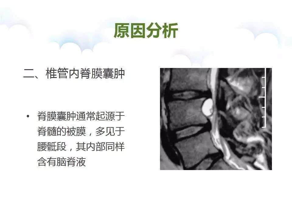 腰穿脑脊液有异常怎么治疗,腰麻脑脊液回流不畅