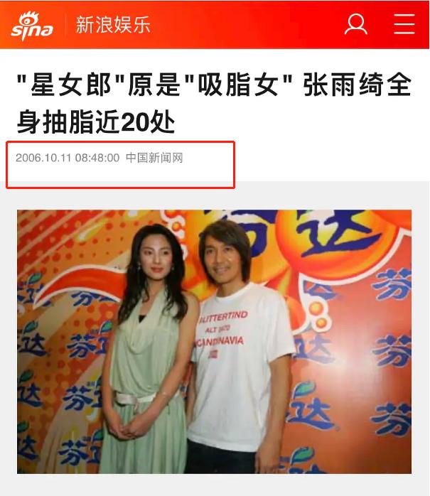 张雨绮腿抽脂,张雨绮抽脂瘦脸了么