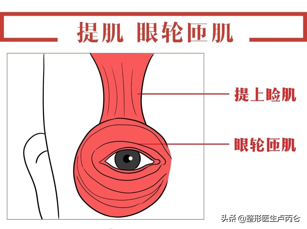 眼袋手术的副作用有哪些,眼袋手术最常见的并发症是