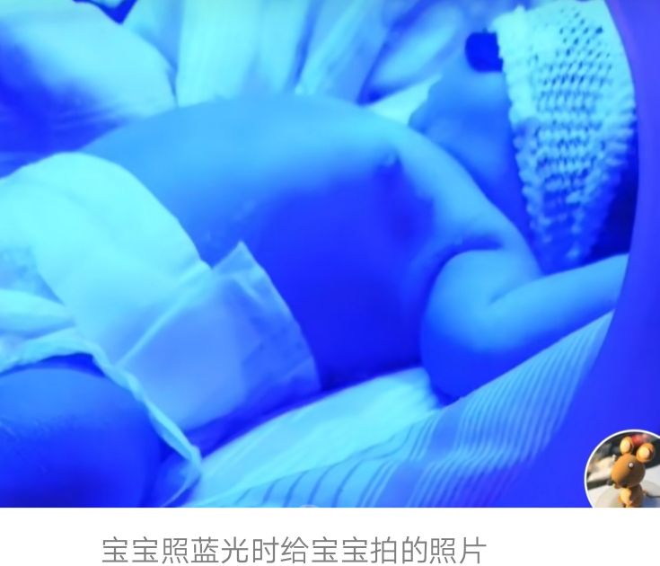 新生儿牛奶蛋白过敏如何转奶,新生儿牛奶蛋白过敏拉血多久能好