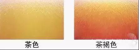 池塘水质ph值7.4是酸性还是碱性,怎样判断池塘水质