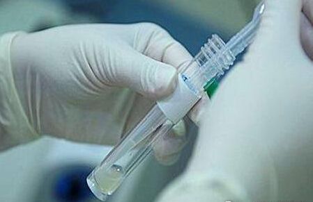 精子科普小知识动画,精子检查解说