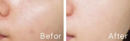 好皮肤怎么样养成的,好脸蛋