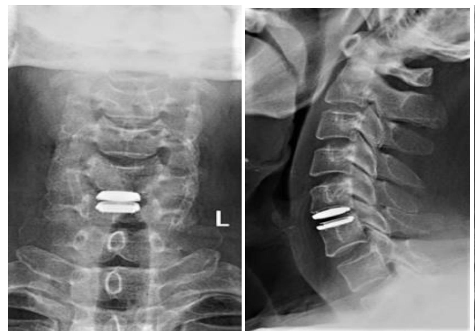 张忠根教授授课简介,李春根发改委