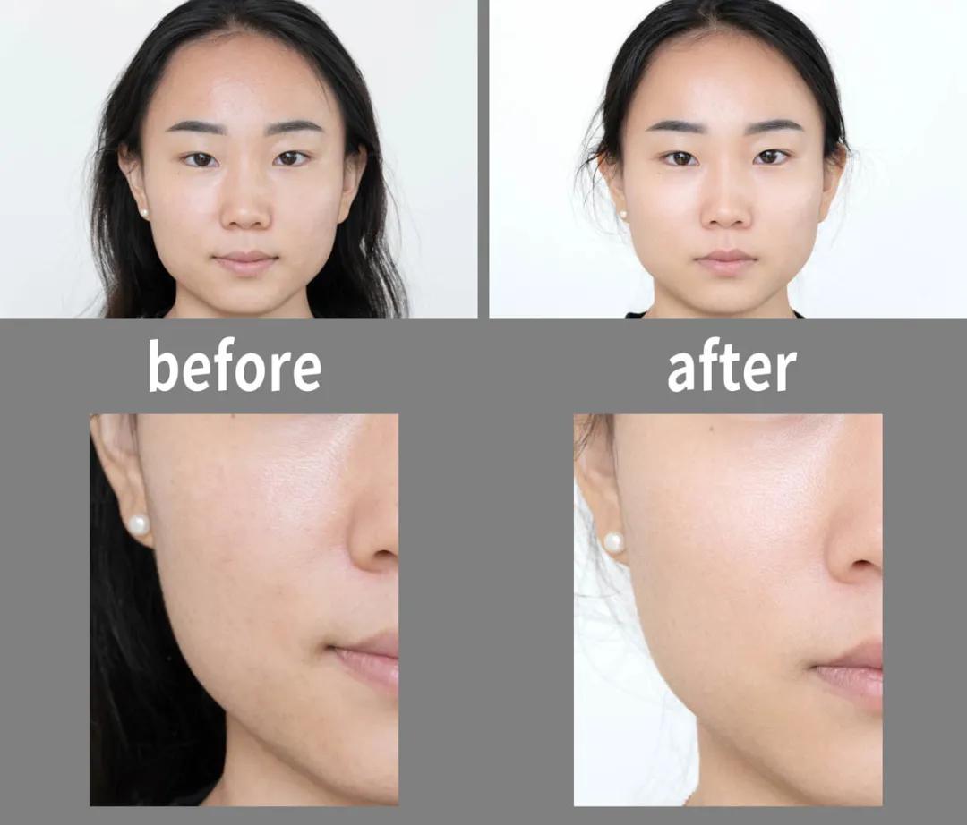 美肌‖他们要怎么做，才能让肤质显好不显老？