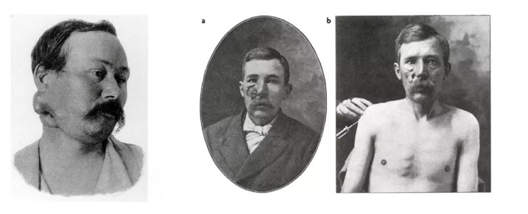 逆袭神药,被忽略的国产神药