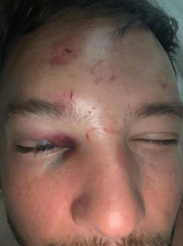 喝酒误事！国外喝水哥喝醉抢别人女朋友，国内张鹭醉驾被拘留