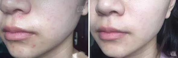 火到断货的“明星级”点斑笔，坚持每天点一下，14天养成初恋脸