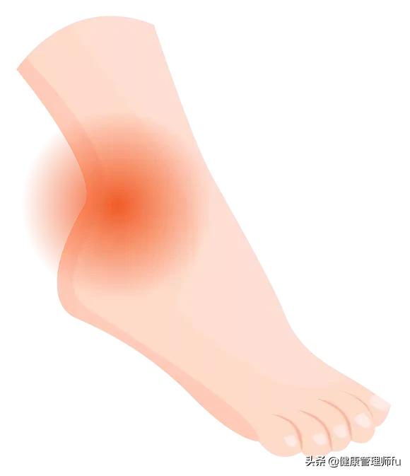 有人容易崴脚,护踝真的可以预防崴脚吗