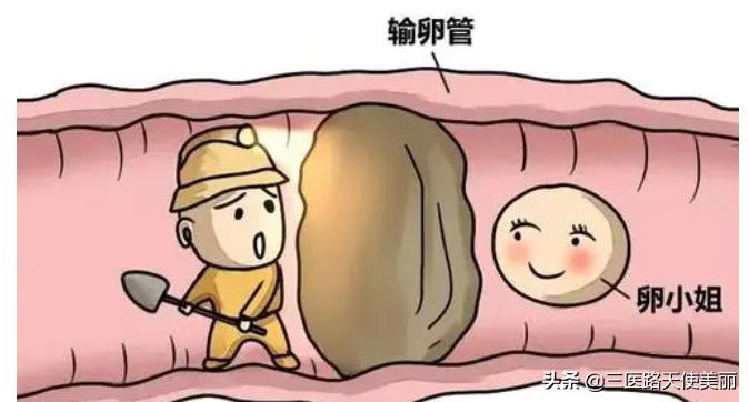 女性不孕不育原因,中医讲不孕不育的5大原因