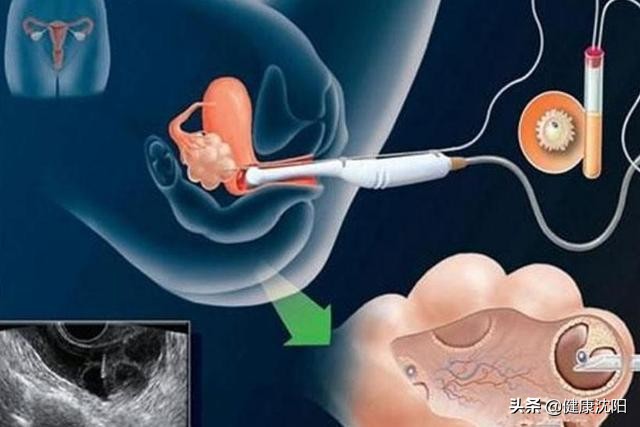 健康科普疼痛视频,肚子疼做腹部超声波能看出来吗