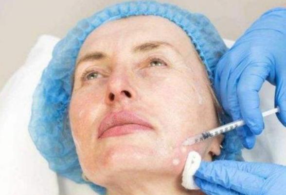 注射玻尿酸属于什么医美技术,注射玻尿酸国产和进口有什么差别