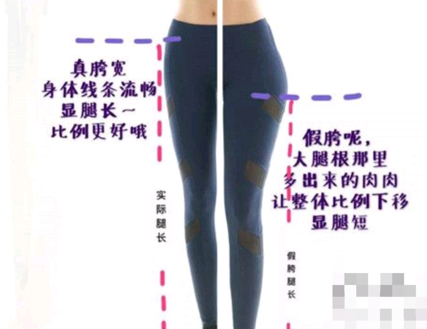 如何消除假髋,怎样纠正假髋宽