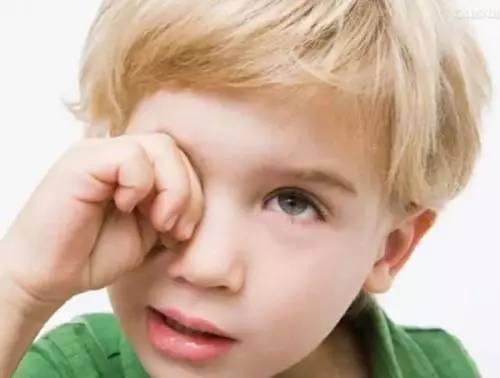 宝宝结膜炎如何照顾,宝宝结膜炎怎么快速治愈