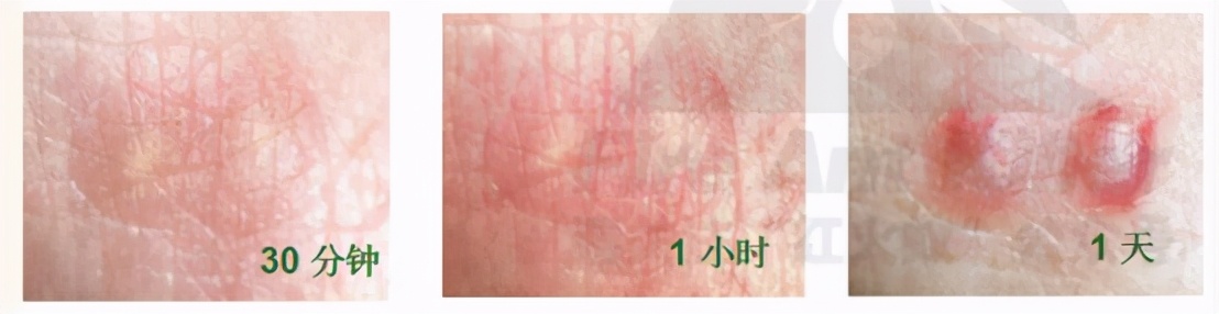 南沙｜@东涌街坊，专家建议，红火蚁得这样治