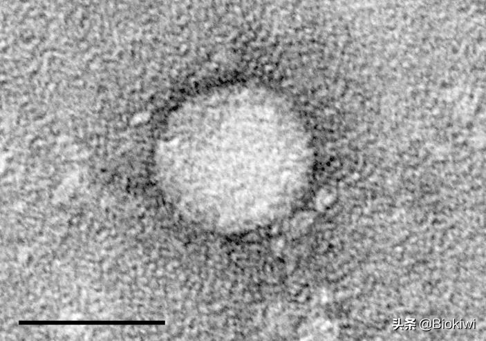 丙肝没病毒了还需要治疗吗,没有病毒的丙肝能传染吗