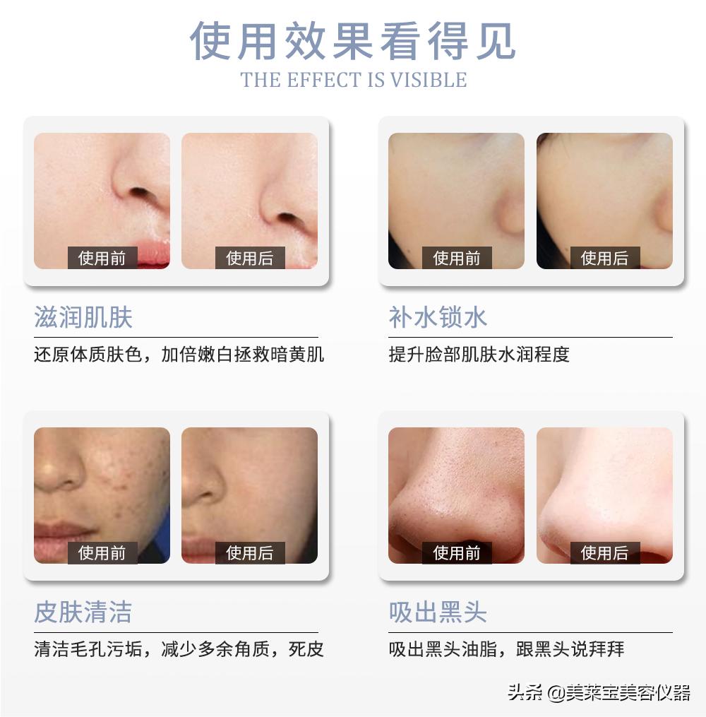 做了小气泡毛孔变大了怎么办,脸部做完小气泡清洁后毛孔变大