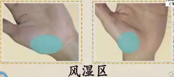 手上7个小细节竟然暗藏大健康,手诊10种常见病从手上就能看出来