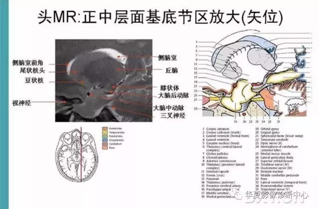 mra头颅解剖学详细讲解视频,常见的头颅mri图像