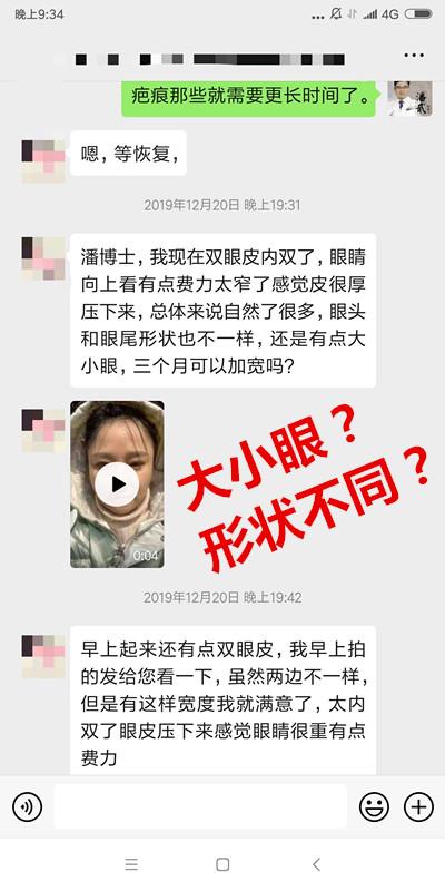 双眼皮修复要对医生说实话吗,双眼皮失败可以修复的几率有多大