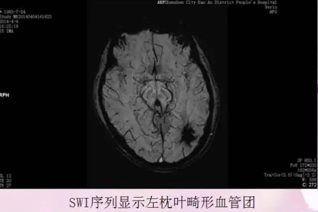 核磁共振能看出来哪些病症,核磁共振可以检查良恶性吗