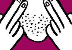 脸色发黄毛孔粗大出油严重怎么办,脸部爱出油长痘毛孔粗大怎么调理